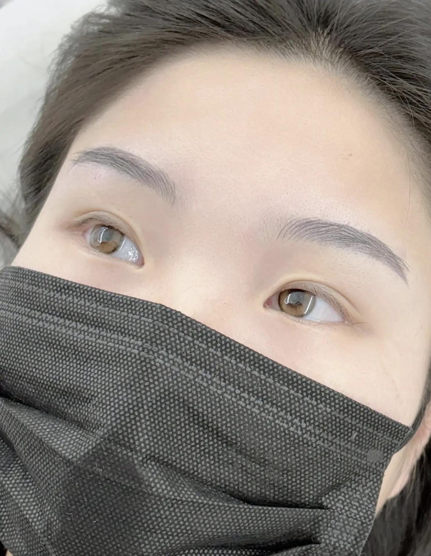ingrown eyebrow hair after waxing